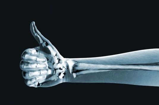 Radiografia per diagnosticare il dolore alle articolazioni delle dita
