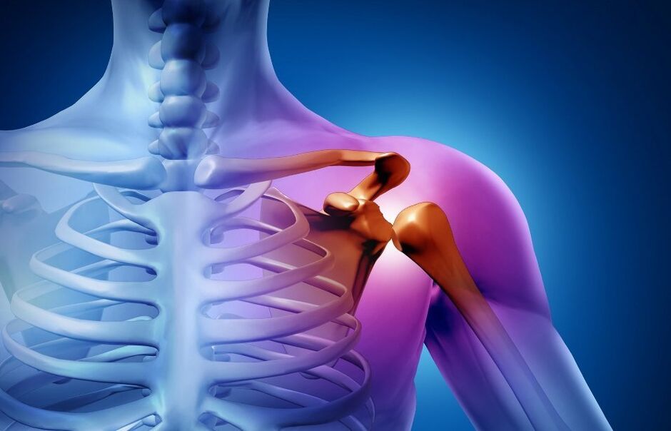 lesione dell'articolazione della spalla per artrosi