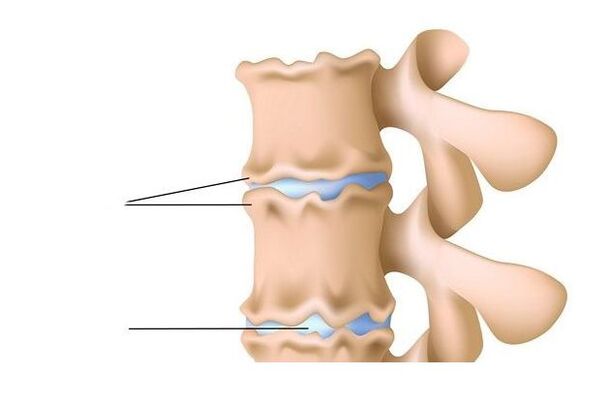 lesione alla colonna vertebrale
