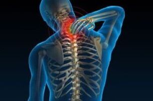 L'osteocondosi cervicale porta al dolore al collo